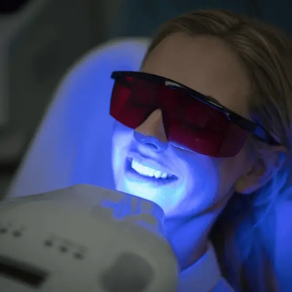 How Does Laser Whitening Adapt for Clients with Retainers Cannock